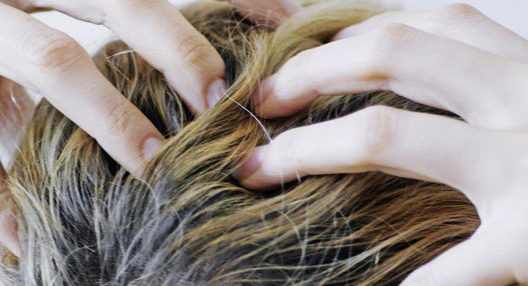 Ce cauzeaza mâncărimea scalpului si caderea parului?