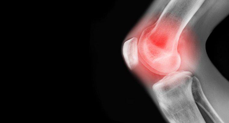 Care sunt unele cauze de durere la nivelul genunchiului stâng?