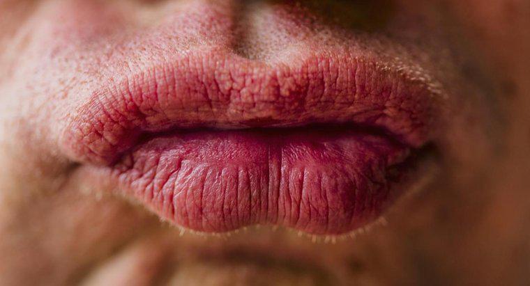 Cum tratezi buzele care sunt umflate datorită unei alergii?