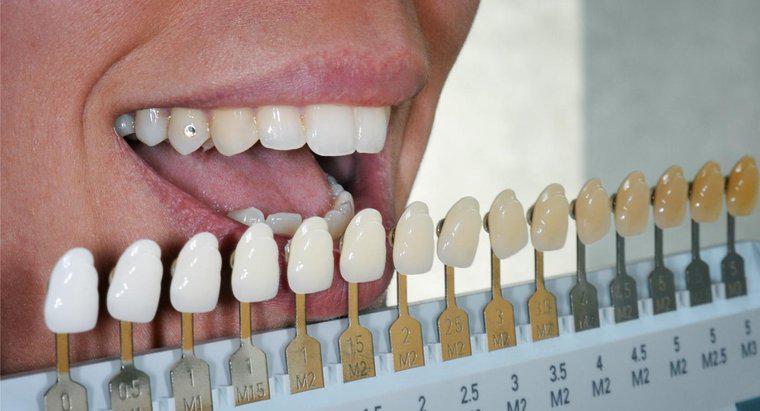 Pot fi albiți dinții fals?