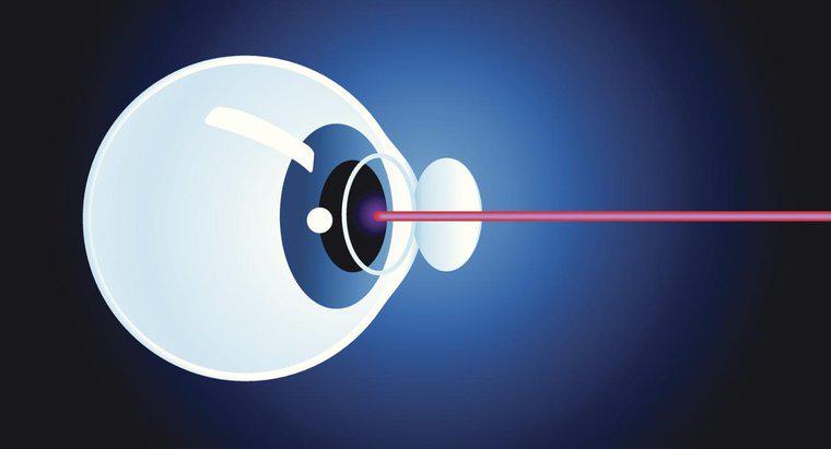 Ce este chirurgia cu cataractă cu laser?