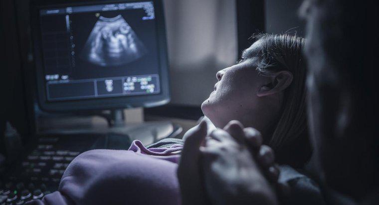 Cât de departe trebuie să fii pentru a auzi un bătăi cardiace în timpul unui ultrasunet?