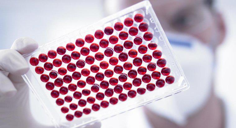 Ce înseamnă MPV scăzut într-un test de sânge?