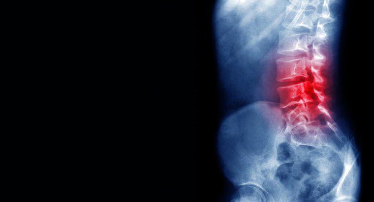 Care sunt cauzele pentru dureri de spate inferioare?