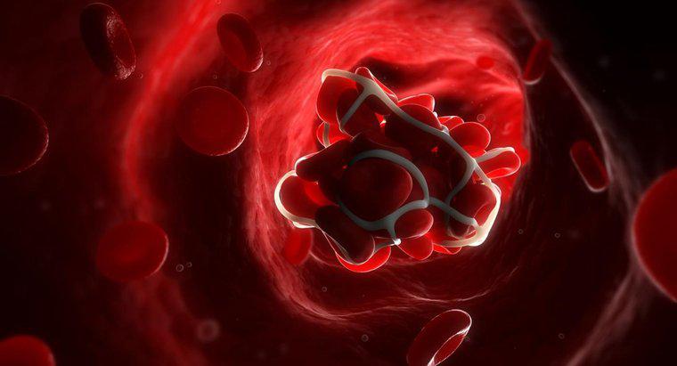 Care sunt simptomele unui cheag de sange in gat?